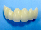 ジルコニア系セラミックス（セルコンZ冠）前歯部